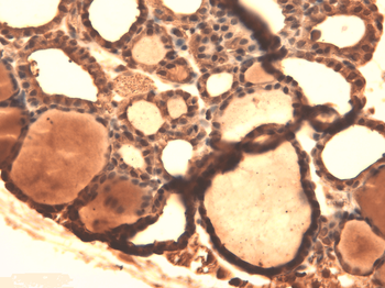 Sodium-Iodide Symporter Antibody: PerCP