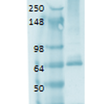 Sodium Iodide Symporter Antibody (RPE)