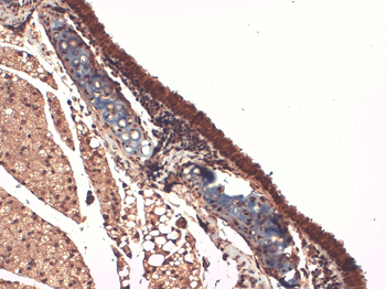 Sodium Iodide Symporter Antibody (RPE)
