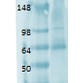 Sodium-Iodide Symporter Antibody: PerCP