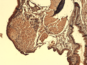 Sodium-Iodide Symporter Antibody: PerCP