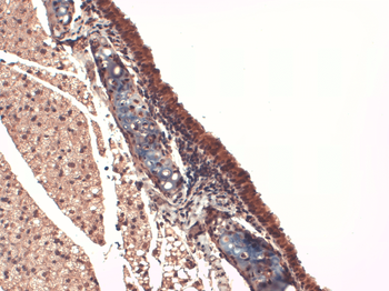 Sodium Iodide Symporter Antibody (RPE)