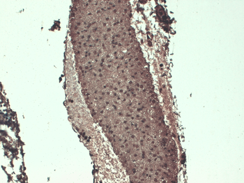 Sodium Iodide Symporter Antibody (RPE)