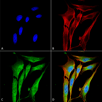 VAChT Antibody: FITC