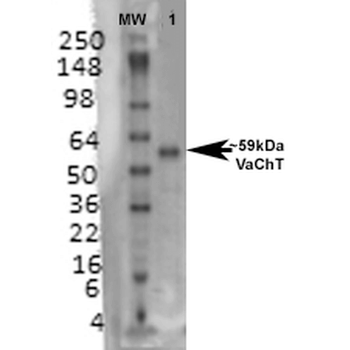VAChT Antibody: FITC