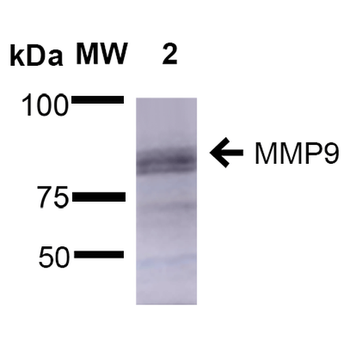 MMP9 Antibody: HRP