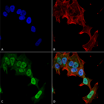 mGluR1/5 Antibody: FITC