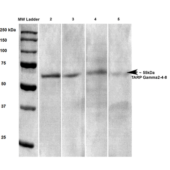 Stargazin Antibody (PerCP)