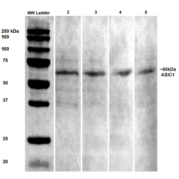 ASIC1 Antibody (RPE)