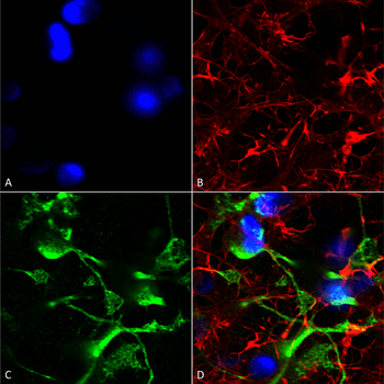 SUR2A Antibody (HRP)