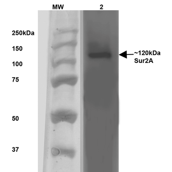 SUR2A Antibody (RPE)