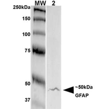 GFAP Antibody: FITC