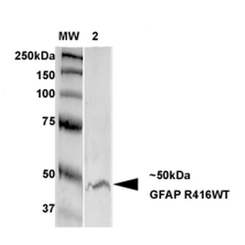 GFAP Antibody (RPE)
