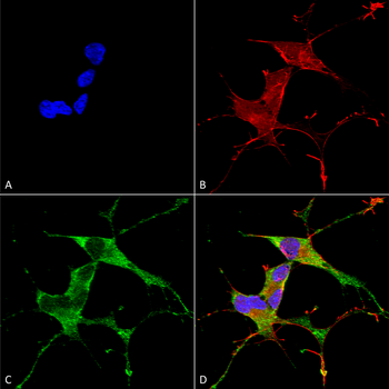 LRRK2 Antibody (FITC)