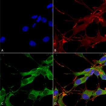 LRRK2 Antibody (FITC)