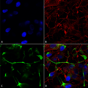 ATF4 Antibody
