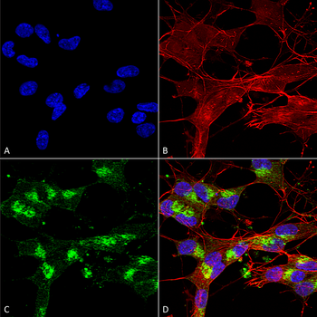 VDAC1 Antibody: RPE