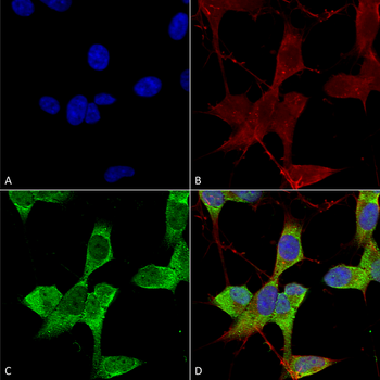 TASK1 Potassium Channel Antibody: APC