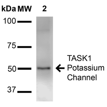 TASK1 Potassium Channel Antibody: APC
