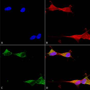 Ataxin 1 Antibody