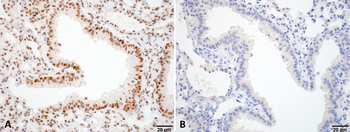 HSF1 Antibody: HRP