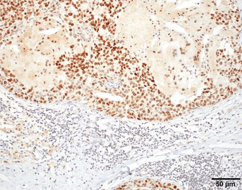 HSF1 Antibody: RPE