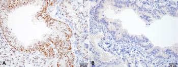 HSF1 Antibody: HRP