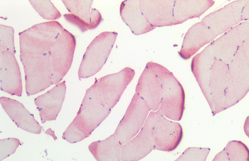 HSP27 Antibody: Biotin