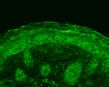 Calnexin-CT Antibody: APC