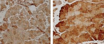 SOD (Mn) Antibody: Biotin
