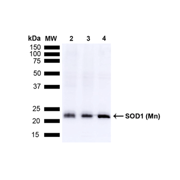 SOD (Mn) Antibody: Biotin
