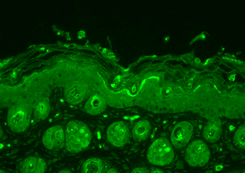 Ubiquitin Antibody (RPE)