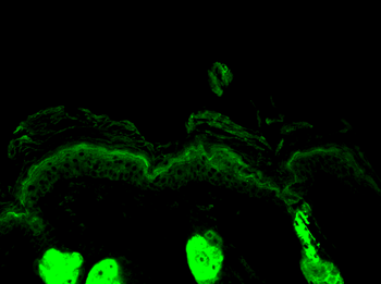 Calreticulin Antibody: HRP