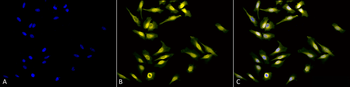 Calreticulin Antibody: HRP