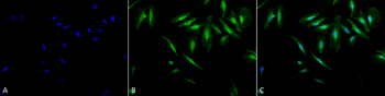 Alpha B Crystallin Antibody: HRP