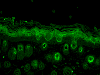 Rab5 Antibody: APC