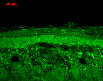 HSP22 Antibody: RPE