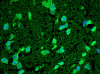 HSP22 Antibody: RPE