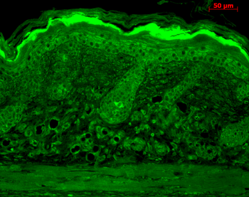Calnexin-CT Antibody: HRP