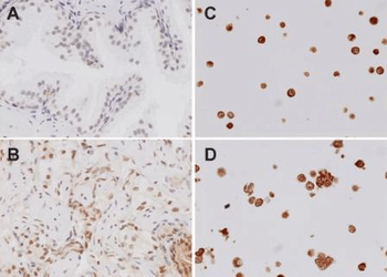 TLR4 Antibody: PerCP