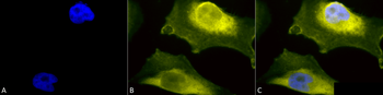 SOD1 (UbetaB) Antibody: FITC