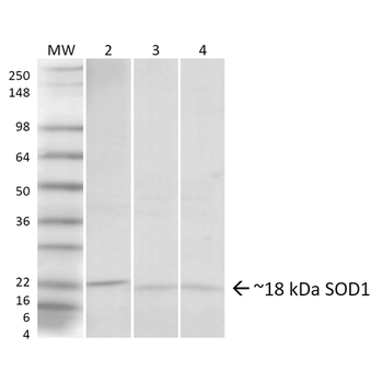 SOD1 (UbetaB) Antibody: FITC