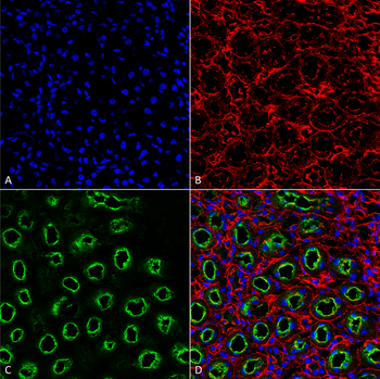 NKCC2 Antibody (PerCP)