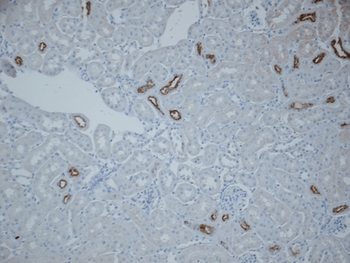 NCC Antibody: HRP
