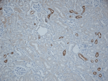 NCC Antibody: PerCP