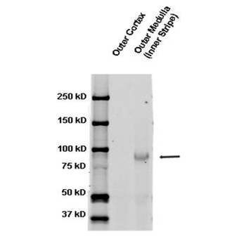 ENaC beta Antibody: HRP