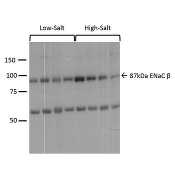 ENaC beta Antibody: HRP
