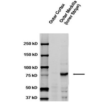 ENaC gamma Antibody: HRP