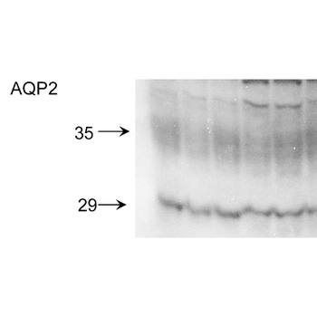 Aquaporin 2 Antibody: FITC