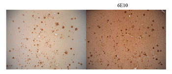 Amyloid Fibrils (OC) Antibody: RPE